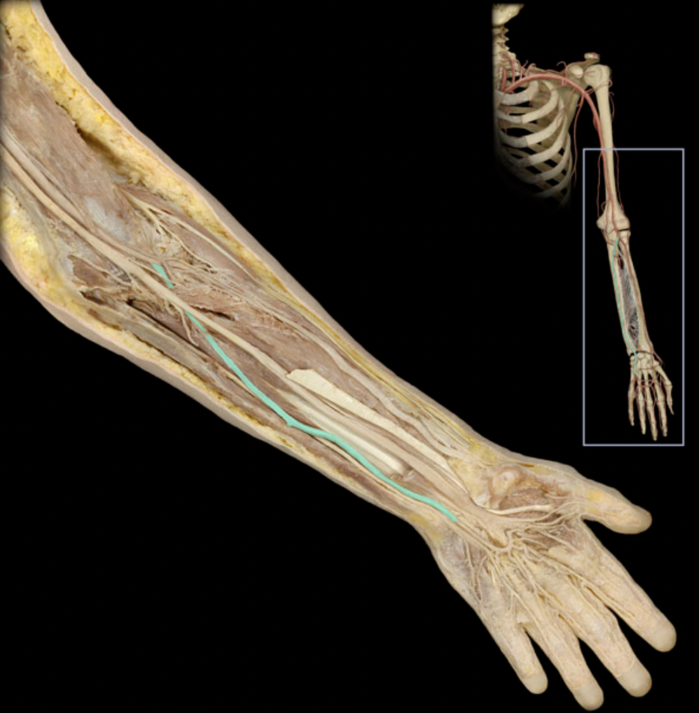 <p>Identify the blood vessel of the upper extremity</p>