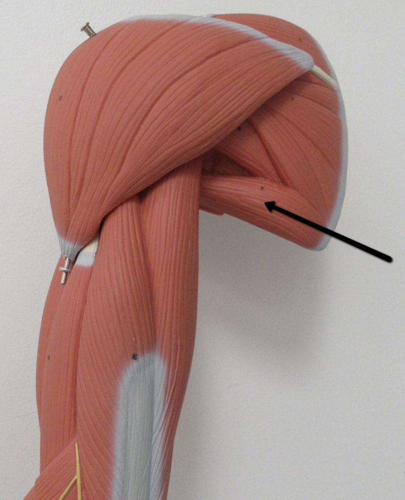 <p>Identify the muscle indicated by the pointer.</p>