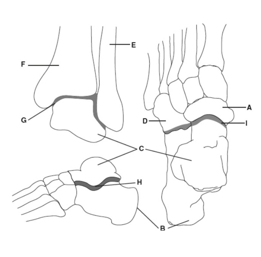 <p>B</p>