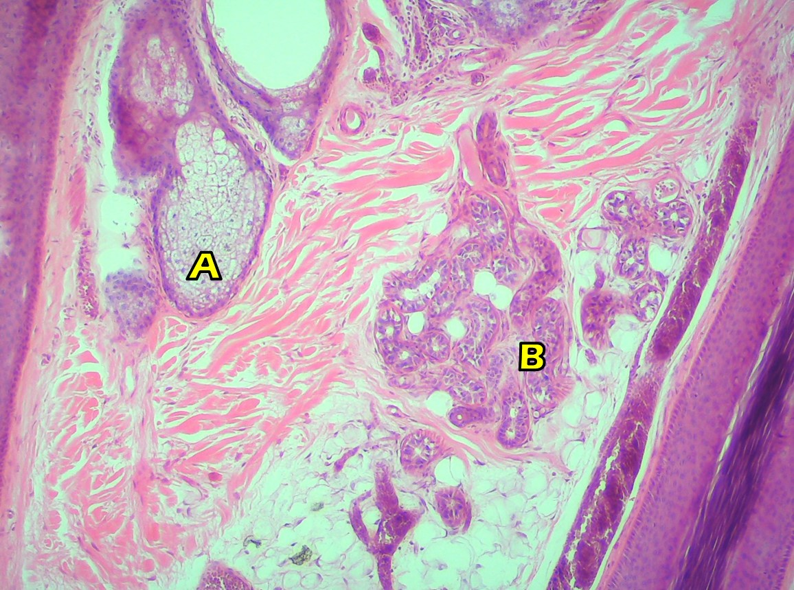 <p><span>Which structure is the sebaceous gland?</span></p>