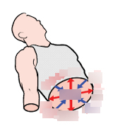 <p>Blue arrows</p>