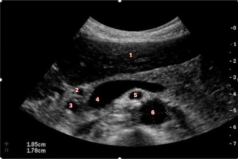 <p>Which of the following structures is labeled #2?</p>