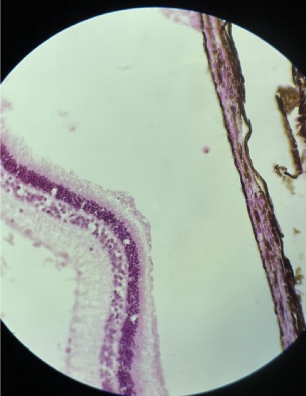 <p>The posterior portion of the rabbit eye containing $$8$$ layers.</p>
