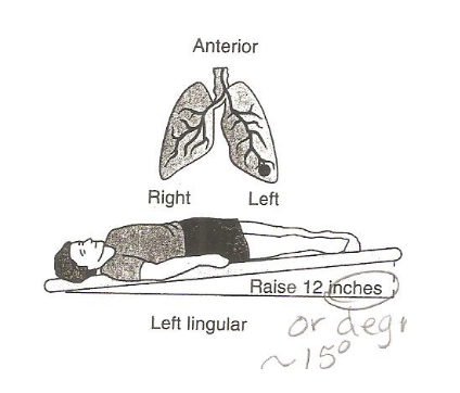 <p>left lingular anterior</p>