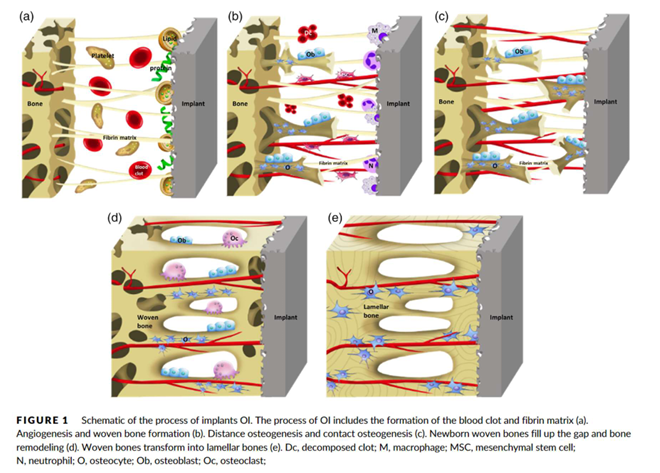 <p>more complex procedure, very sensitive to surgical technique</p>