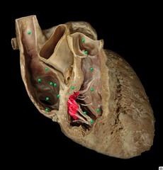 <p>identify the structure</p>