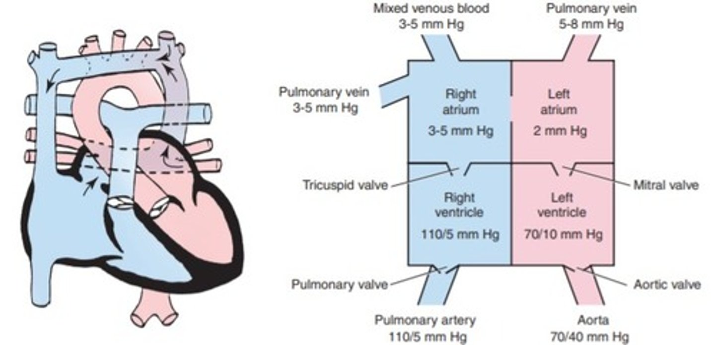 <p>a. coarctation of the aorta</p><p>b. aortic stenosis</p><p>c. transposition of the great vessels</p><p>d. Total anomalous pulmonary venous return</p>