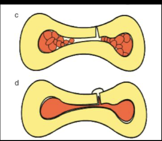<p>which is showing cold lateral condensation vs warm vertical condensation </p>