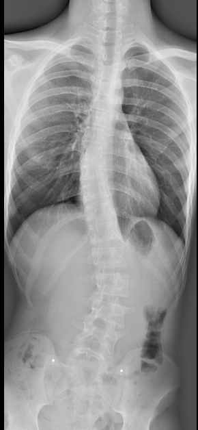<p><strong>INTRO</strong></p><p>Beschrijf deze full spine foto. </p>