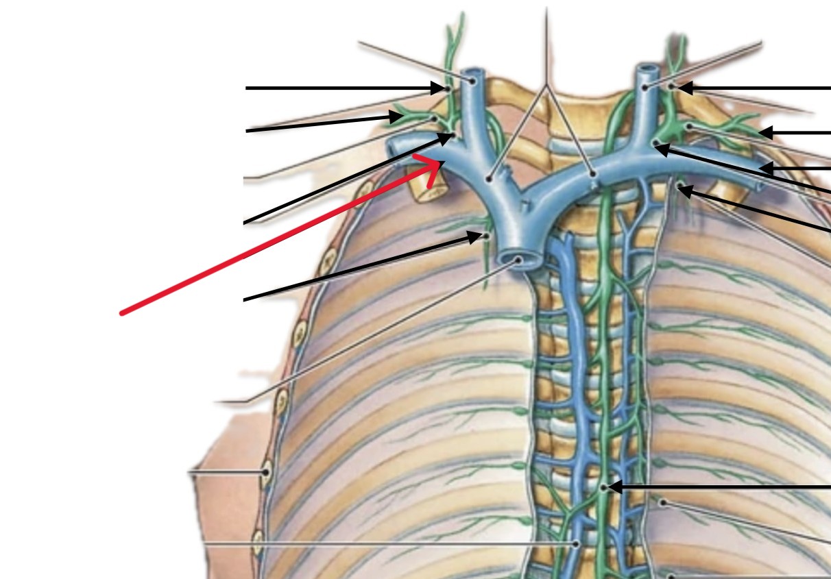<p>Which lymphatic vein:</p><ul><li><p>Under right clavicle bone</p></li></ul><p></p>