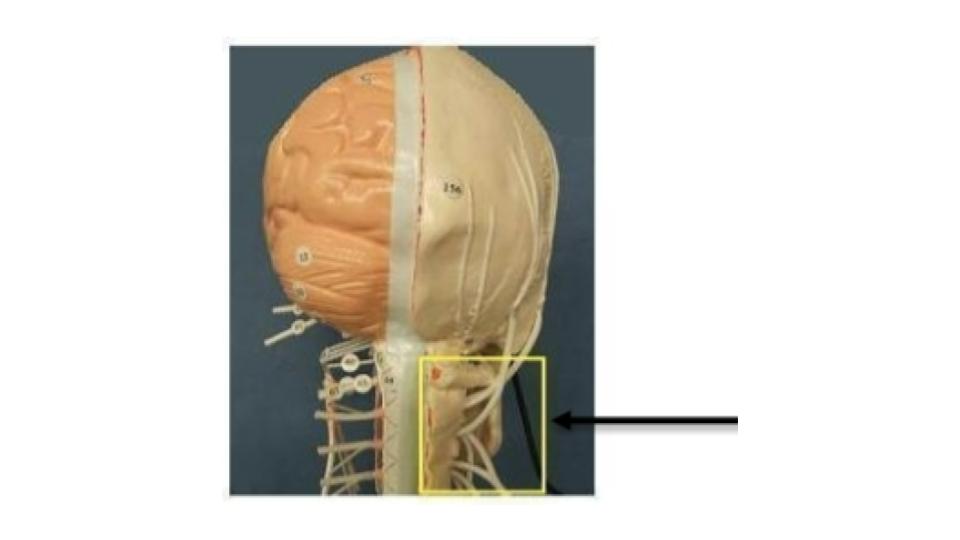 <p>nerve network</p>