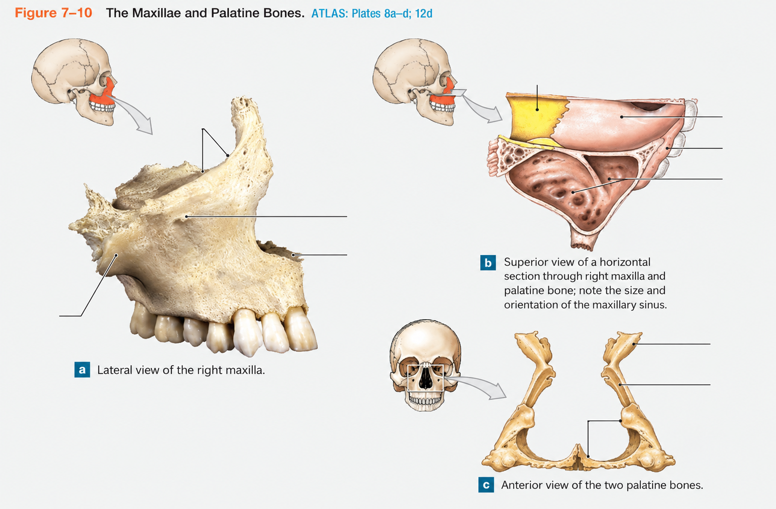 <p>Name the bone (3)</p>