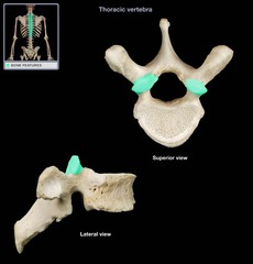 <p>Category: Typical Vertebra</p>