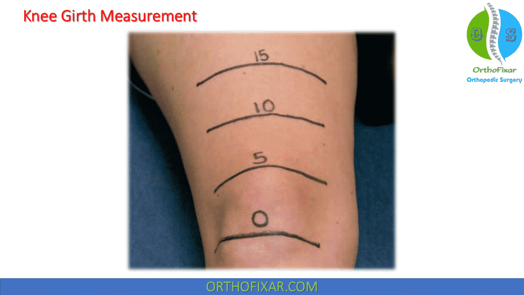 <p>positive test: difference of ±1 cm compared bilaterally</p><p>implications: increased girth on injured side across joint line - edema, decreased muscular girth on injured side - atrophy</p>