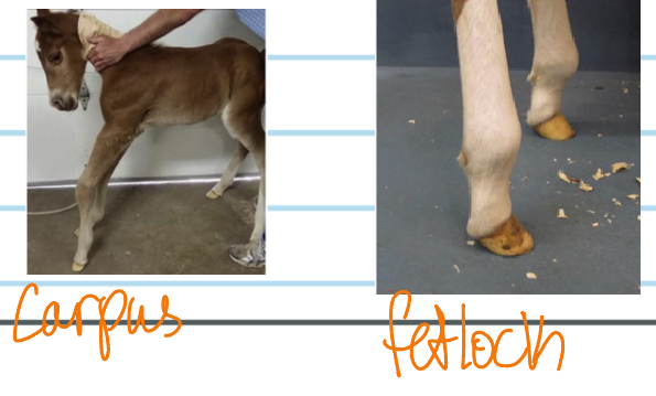 <p>Flexural Deformities (Club foot):C.S</p>