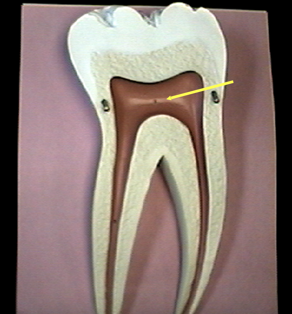 <p>Identify the organs of the digestive tract.</p>