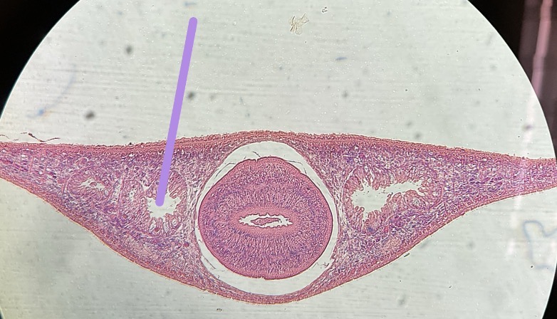 <p>What is this structure </p>