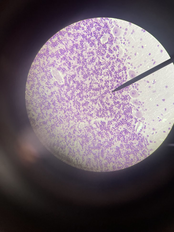 <p>tissue type + name (cerebellum)</p>