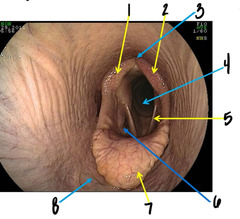 <p>What is 3?</p>