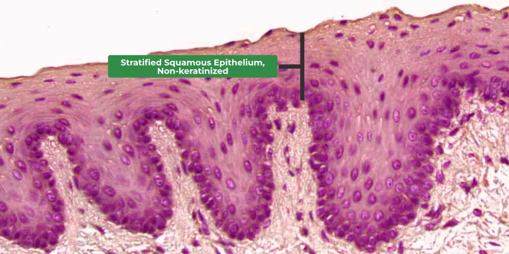 <p>top older layer clearly stratified, bottom layers undefined cells (new developing cells), curvy structure</p>