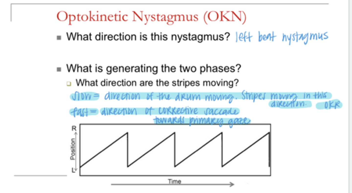 <p>The slow phase of OKN is in the direction of the ______</p>