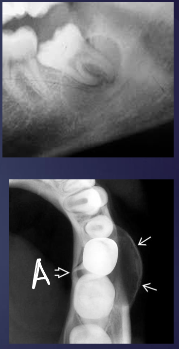 <p>what is this and what is A pointing to?</p>