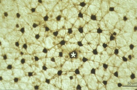 <p>Horizontal cells are extensively electrically coupled (via gap junctions), allowing signals to spread laterally across many cells.<br>This electrical coupling explains why horizontal cell receptive fields extend far beyond their dendritic spread.</p>
