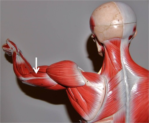 <p>What muscle is this?</p>