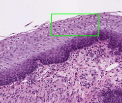 <p>stratified squamous</p>