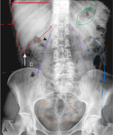 term image