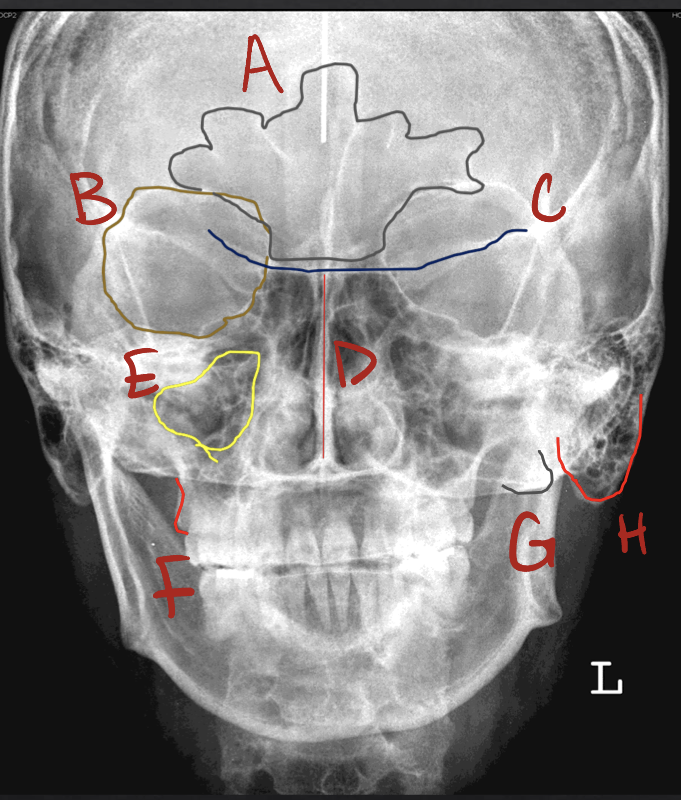 <p>b?</p>
