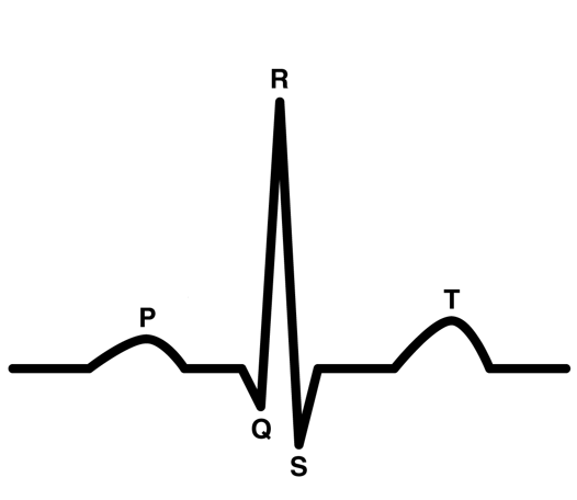 <ul><li><p>flat lines: no electrical activity</p></li><li><p>upward spikes: depolarization</p></li><li><p>downward spikes: repolarization</p></li></ul><p></p>