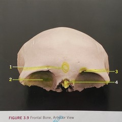 <p>disarticulated</p>