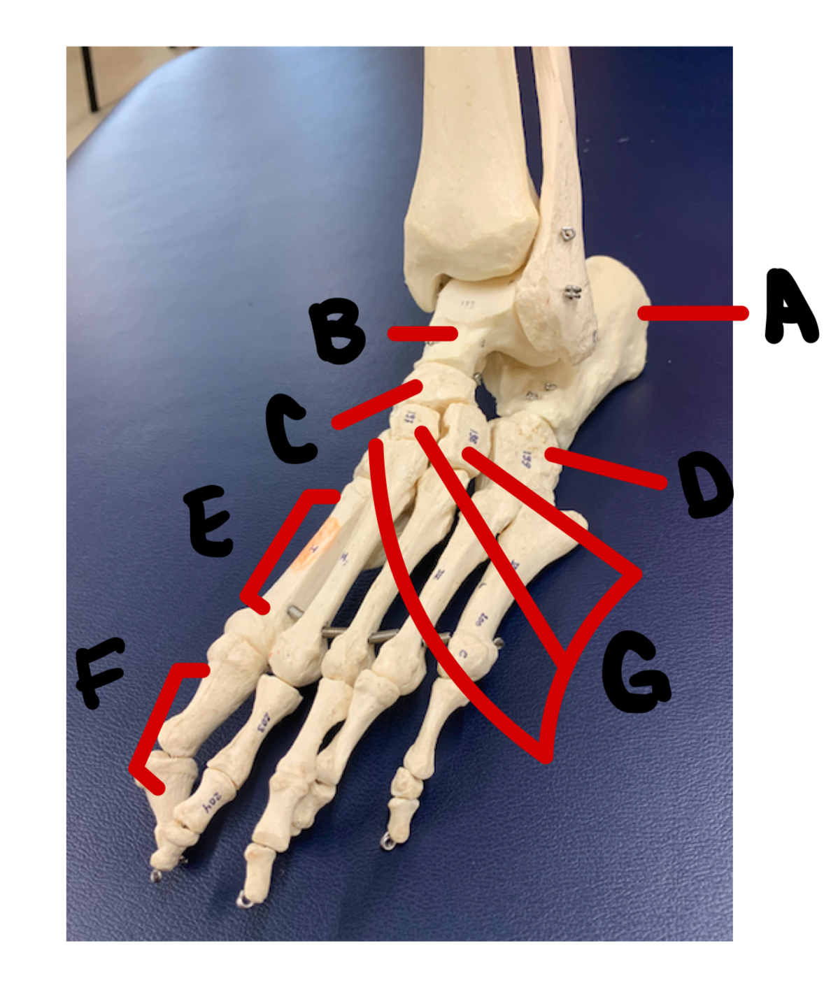 <p>B</p>