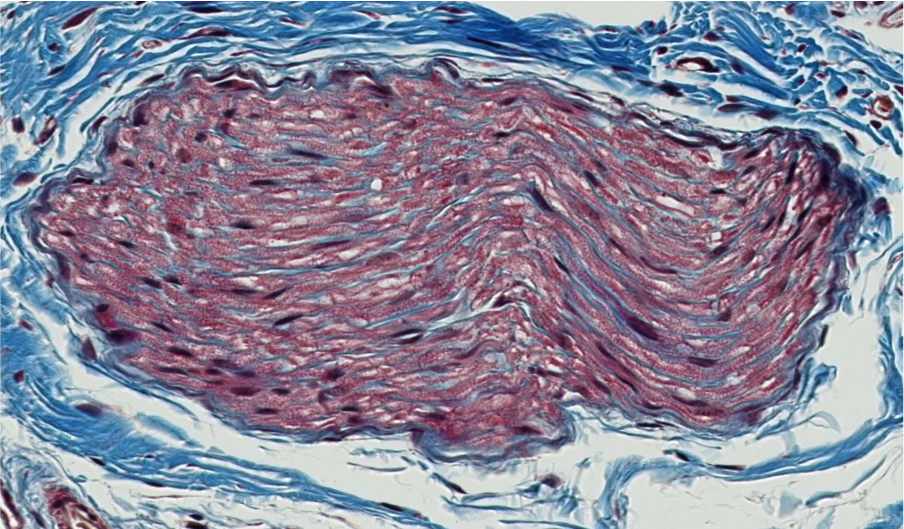 <p><span style="font-family: "Calibri Light";">Is this nerve fascicle myelinated or unmyelinated?</span></p>