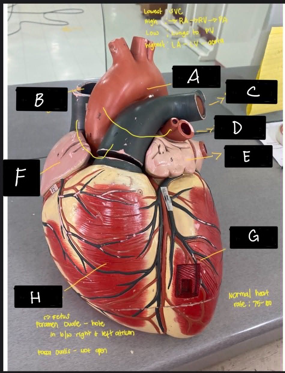 <p>Identify H</p>