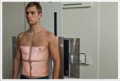 <p>CR 2 inches (5 cm) above iliac crest and mid sag</p><p>Arms by sides and away from abdomen</p><p>No rotation of shoulders and pelvis</p><p>Exposure taken on expiration</p>