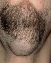 <ol start="88"><li><p>Identify the finding shown.</p></li></ol><p></p>