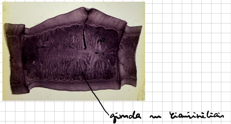 <p>Jautinis kaspinuotis - taenia saginata (subrendes narelis)</p>