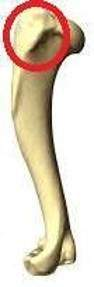 <p>Tubercle </p>