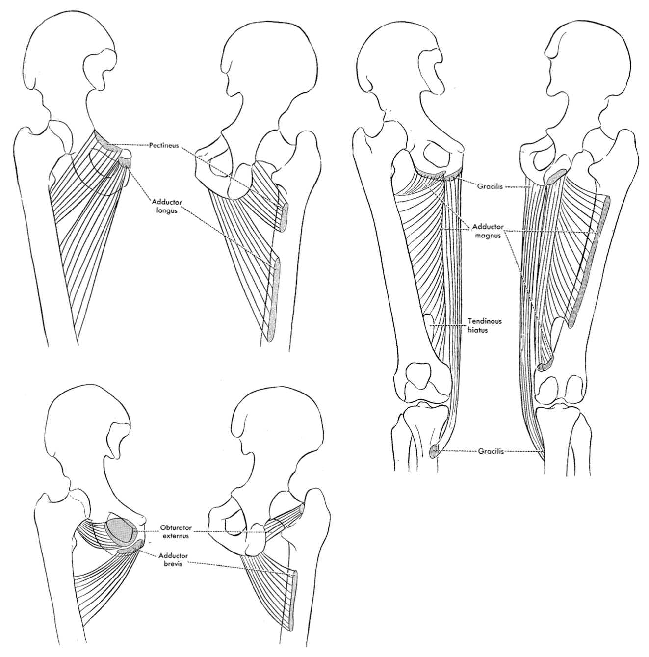<p></p><p>malleus </p>