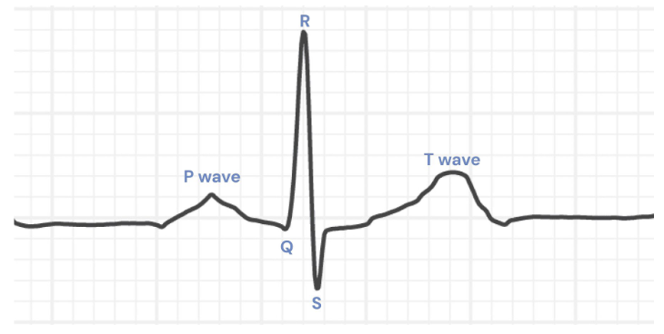 <ul><li><p>P wave</p><ul><li><p>Atrial contraction</p></li><li><p>Generated by the SA node</p></li><li><p>Atrial depolarization occurs</p></li></ul></li><li><p>QRS</p><ul><li><p>Ventricular contraction</p></li></ul></li><li><p>T wave</p><ul><li><p>Ventricular relaxation</p></li></ul></li></ul><p></p>