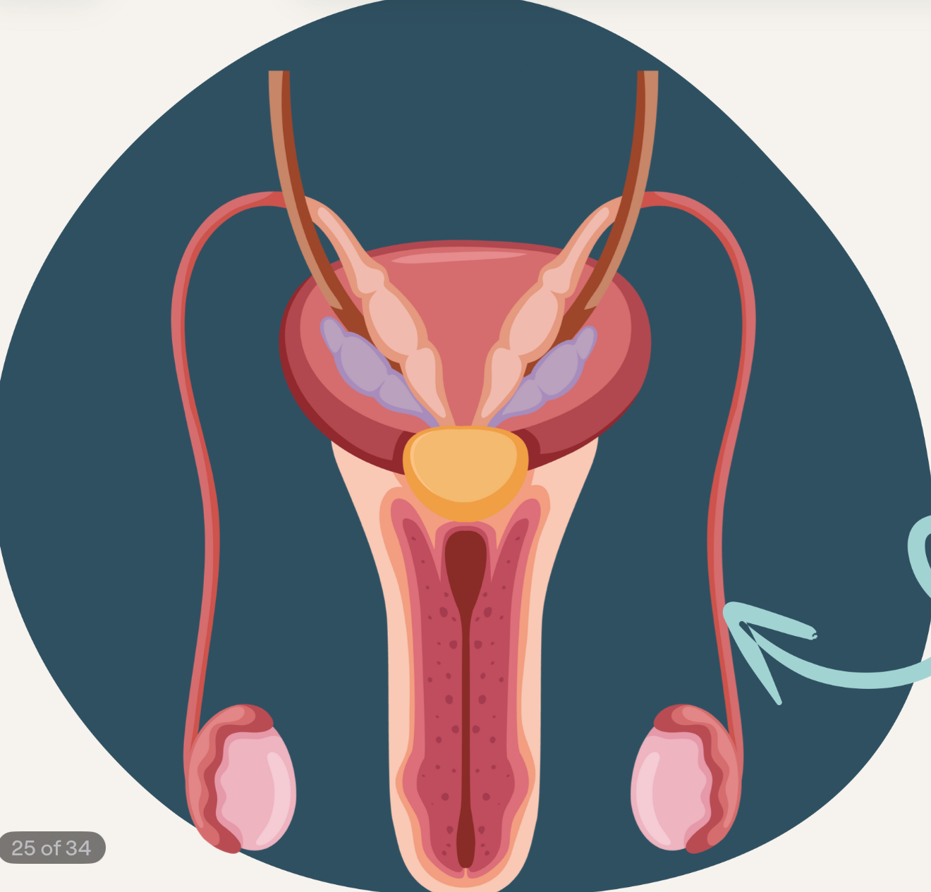 <p>long, muscular tube that serves as passageway of the sperm cells released from the testes</p><ul><li><p>connects testes to the seminal vesicle and urethra</p></li><li><p>smooth muscle</p></li><li><p>transports mature sperm to urethra for ejaculation</p></li></ul><p></p>