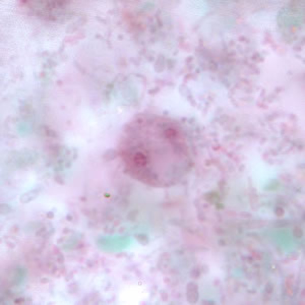 term image