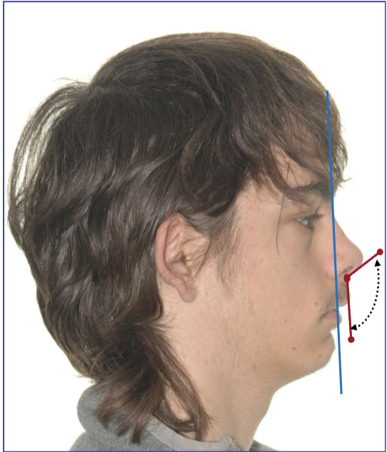 <p>what angle is this </p>