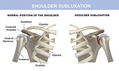 <p>What injury / condition? </p>
