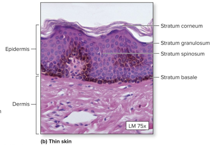 <p>Thin skin</p>