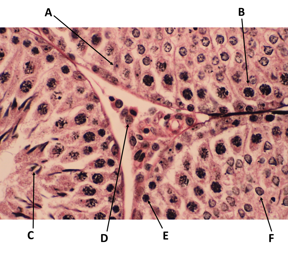 <p><span>Identify the cell labeled with the letter C.</span></p>