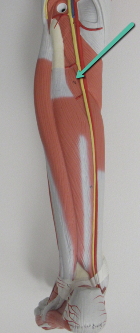 <p>Identify the muscle indicated by the pointer.</p>