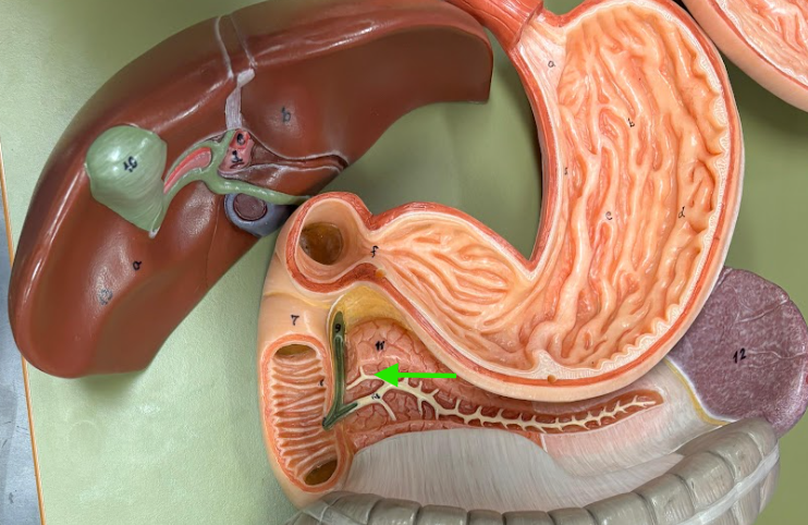 <p>What is the arrow pointing at?</p>